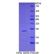 SDS-PAGE analysis of Mouse TNFRSF19L Protein.