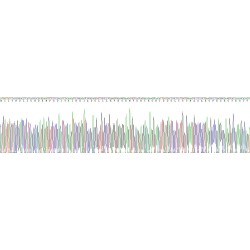 Human Tumor Protein, Translationally Controlled 1 (TPT1) Protein
