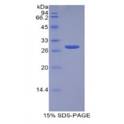 SDS-PAGE analysis of recombinant Human TPT1 Protein.