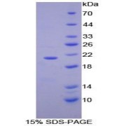 SDS-PAGE analysis of Human VCAM1 Protein.