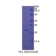 SDS-PAGE analysis of Mouse VCAM1 Protein.