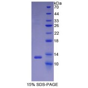SDS-PAGE analysis of recombinant Monkey VCAM1 Protein.