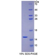 SDS-PAGE analysis of Rat VEGFC Protein.