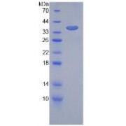SDS-PAGE analysis of Mouse VEGFR1 Protein.