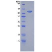 SDS-PAGE analysis of Mouse VEGFR1 Protein.