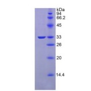 15% SDS-PAGE of Rat VEGFR1 Protein.