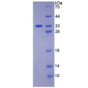 SDS-PAGE analysis of Human VEGFR2 Protein.