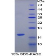 SDS-PAGE analysis of Human Vinculin Protein.