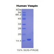 SDS-PAGE analysis of Human Vaspin Protein.