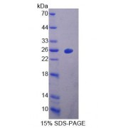 SDS-PAGE analysis of Human DBP Protein.