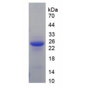 SDS-PAGE analysis of Mouse DBP Protein.