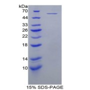 SDS-PAGE analysis of Mouse MYC Protein.