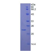 SDS-PAGE analysis of recombinant Rat vWF Protein.