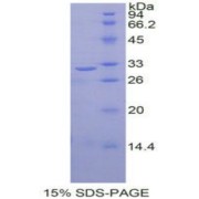 SDS-PAGE analysis of Human RELB Protein.