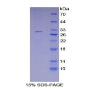 SDS-PAGE analysis of Human LYN Protein.