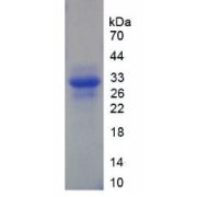 SDS-PAGE analysis of Human XPG Protein.
