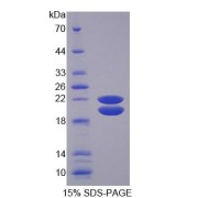 SDS-PAGE analysis of Pig IGFBP3 Protein.