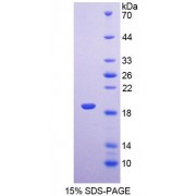 SDS-PAGE analysis of Rat LEPR Protein.
