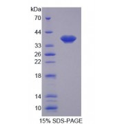 SDS-PAGE analysis of recombinant Rat Matrix Metalloproteinase 1 (MMP1) Protein.