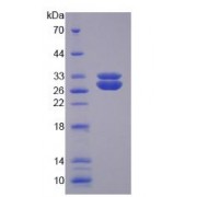 SDS-PAGE analysis of recombinant Human SOD3 Protein.