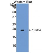 Western blot analysis of recombinant Human CORIN Protein.