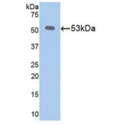 Western blot analysis of recombinant Mouse Klotho.