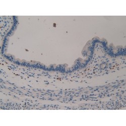 Klotho (KL) Antibody