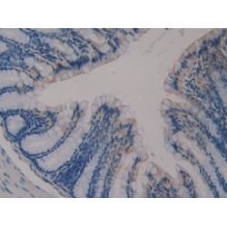 Klotho (KL) Antibody