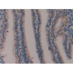 Klotho (KL) Antibody