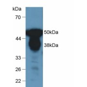 Western blot analysis of Human Urine.