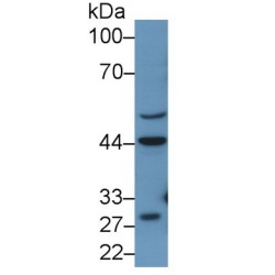 Renin (REN) Antibody