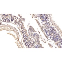 Renin (REN) Antibody