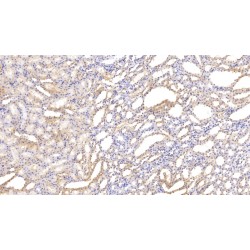 Renin (REN) Antibody