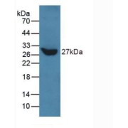 Western blot analysis of recombinant Human TLN1.