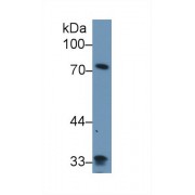 Western blot analysis of Human Lung lysate, using Human ZYX Antibody (1 µg/ml) and HRP-conjugated Goat Anti-Rabbit antibody (<a href="https://www.abbexa.com/index.php?route=product/search&amp;search=abx400043" target="_blank">abx400043</a>, 0.2 µg/ml).