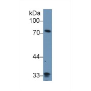 Western blot analysis of Human Lung lysate, using Human ZYX Antibody (1 µg/ml) and HRP-conjugated Goat Anti-Rabbit antibody (<a href="https://www.abbexa.com/index.php?route=product/search&amp;search=abx400043" target="_blank">abx400043</a>, 0.2 µg/ml).