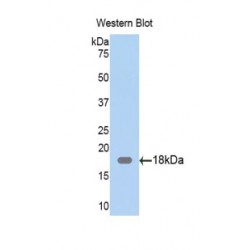 Zyxin (ZYX) Antibody