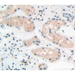 Zyxin (ZYX) Antibody