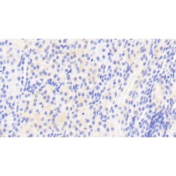 Afamin (AFM) Antibody