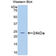 Western blot analysis of the recombinant protein.