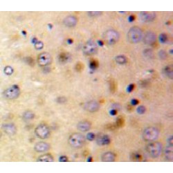 Afamin (AFM) Antibody