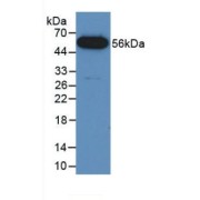 Western blot analysis of recombinant Mouse FUS.
