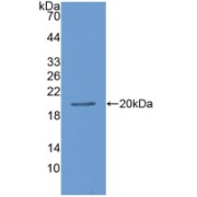 Western blot analysis of recombinant Leptin (LEP) using Leptin (LEP) Antibody.
