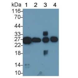 Leptin (LEP) Antibody