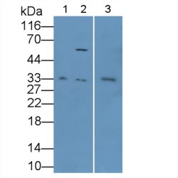 Leptin (LEP) Antibody