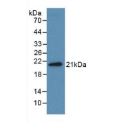 Western blot analysis of recombinant Human Midkine.