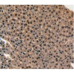 Midkine (MK) Antibody