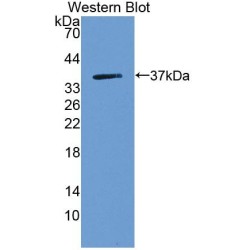 Moesin (MSN) Antibody