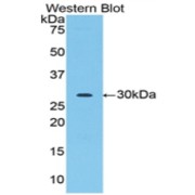 Western blot analysis of the recombinant protein.