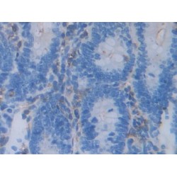 Acrosin (ACR) Antibody